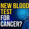ctDNA: The Cancer Discovery Nobody's Talking About