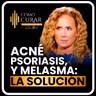 Psoriasis, Acné y Melasma La Causa Que Nadie Te Explica con Michelle Peiret