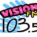 Stereo Vision