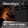 71 #Infecções Odontogênicas - Angina de Ludwig