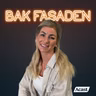 289. Alvorlig fødselsskade