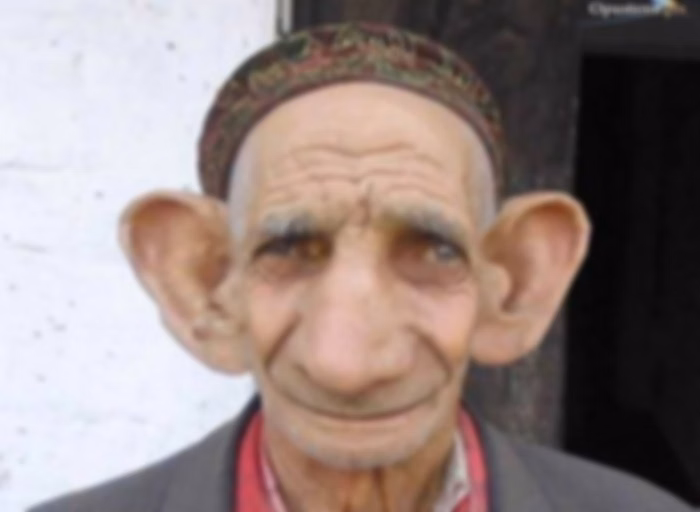 Aca