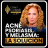 Psoriasis, Acné y Melasma La Causa Que Nadie Te Explica con Michelle Peiret