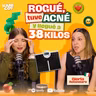 Estuve en TRATAMIENTO para el ACNÉ 😟| Gloria Rotondaro 📱Show de Kani Coy EP125 T03