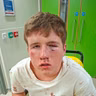 Mother issues plea after teenage son was assaulted