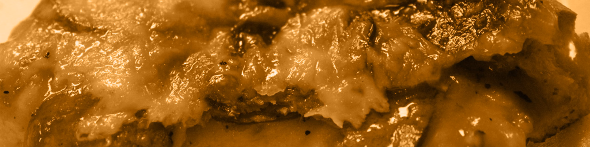 Brown Sauce Radio
