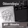 69 #Infecções Odontogênicas - Alveolite