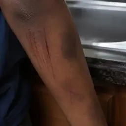 African Mum Living in Balbriggan Demands House Transfer After Children Targeted by Racist Abuse