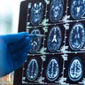 15-year-old receives Motor Neuron Disease diagnosis - family’s appeal