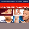 Diabetic Skin Problems That Point to Diabetes