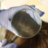 Ask the Expert: Trichologist
