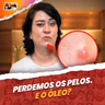 Por que nossa PELE PRODUZ SEBO?