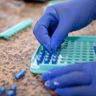 Politicians urge HSE to fund Friedreich's ataxia drug