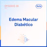 Edema Macular Diabético