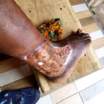 Herbal medicine