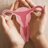 Encore - BABM - PCOS (now PMOS) and Fibroids