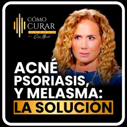 Psoriasis, Acné y Melasma La Causa Que Nadie Te Explica con Michelle Peiret